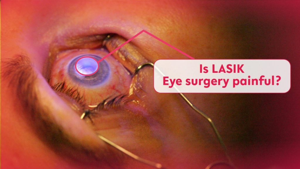 Is LASIK Eye surgery painful