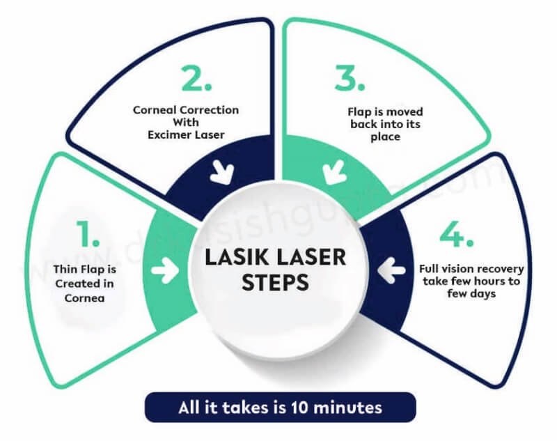 What happens during a LASIK surgery