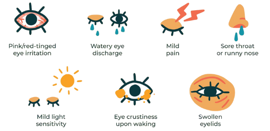 Symptoms Eye Flu