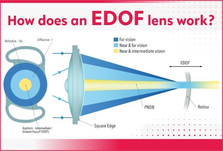 How does an EDOF lens work?