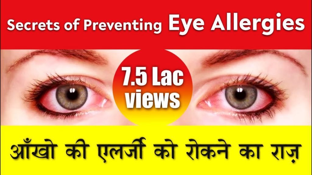 Home Remedies for Eye Allergy