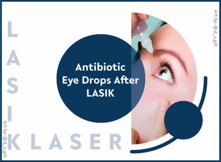 Eye Drops in LASIK Recovery