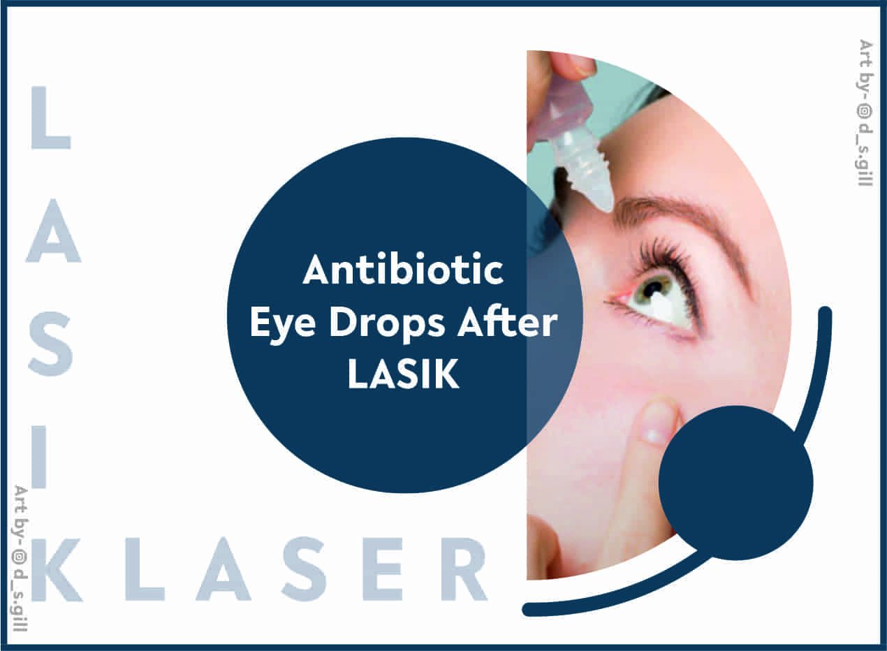 Eye Drops in LASIK Recovery