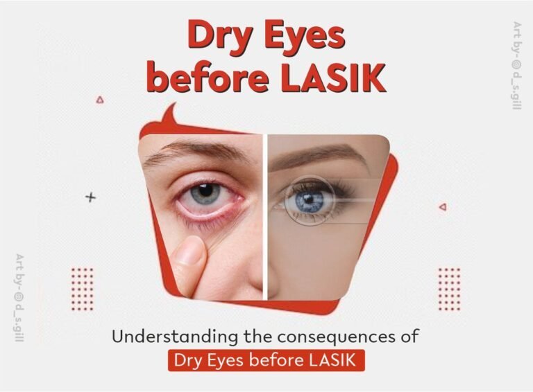 Why Dry Eyes Happen Before LASIK