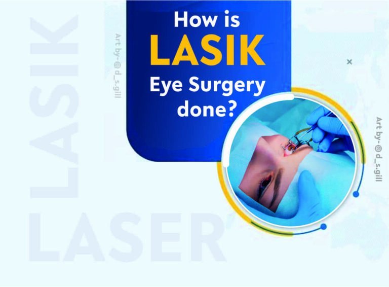 How is LASIK Eye Surgery done?