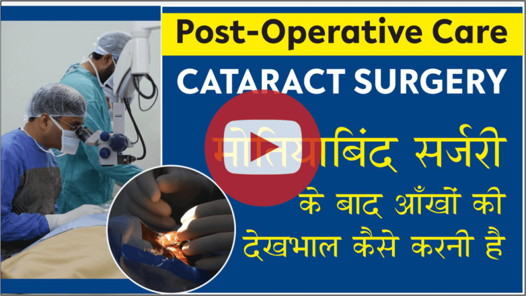 cataract surgery