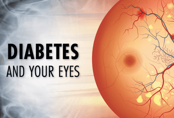 Diabetes affects Your Eye