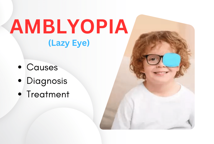 Amblyopia (Lazy Eye): Causes, Diagnosis and Treatment - Best eye ...