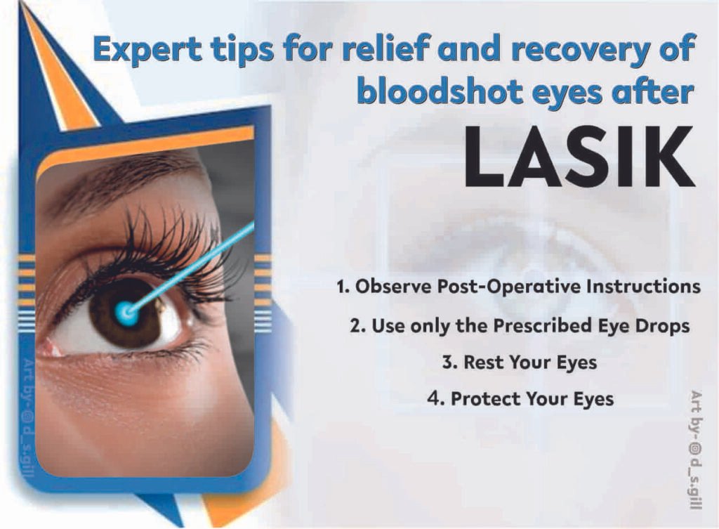 Eyes After LASIK Eye Surgery