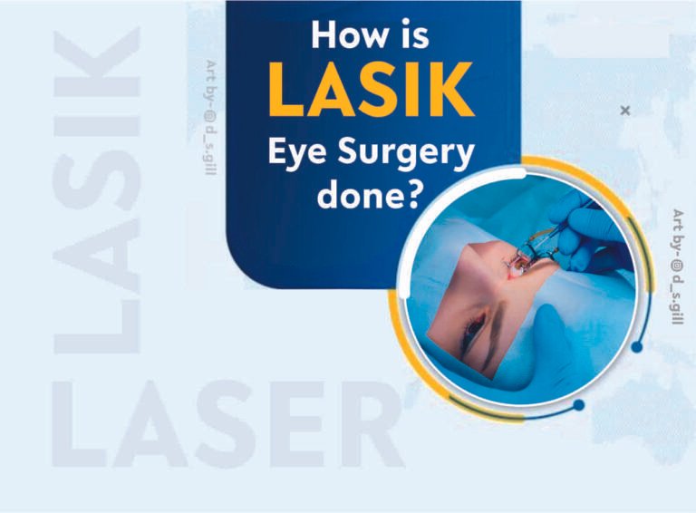 How is LASIK Eye Surgery done?