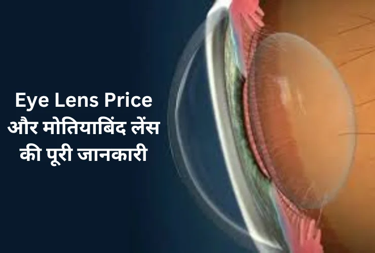 Eye Lens Price