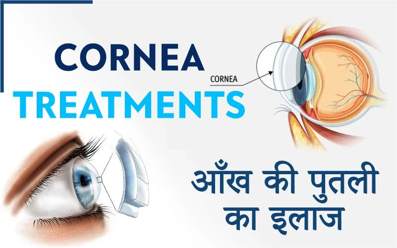 Cornea treatments at Max Hospital Bathinda