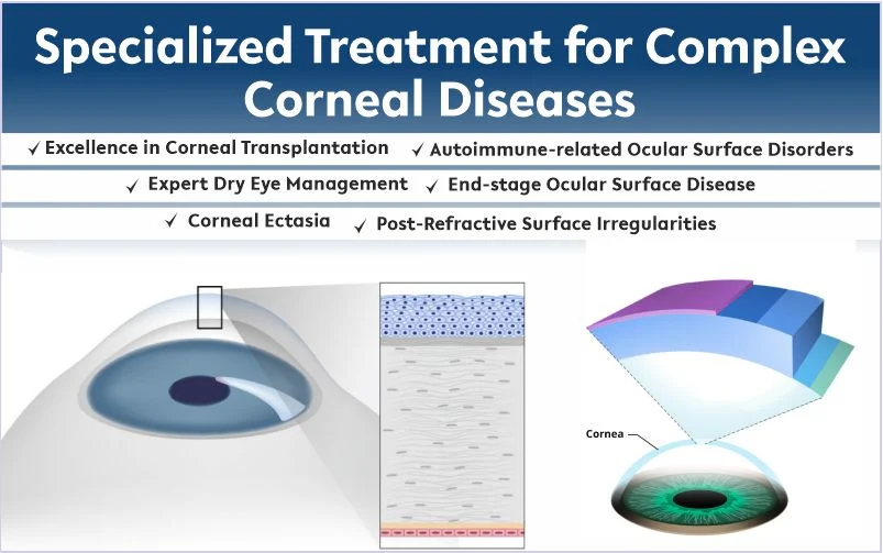 Cornea treatments at Max Hospital Bathinda