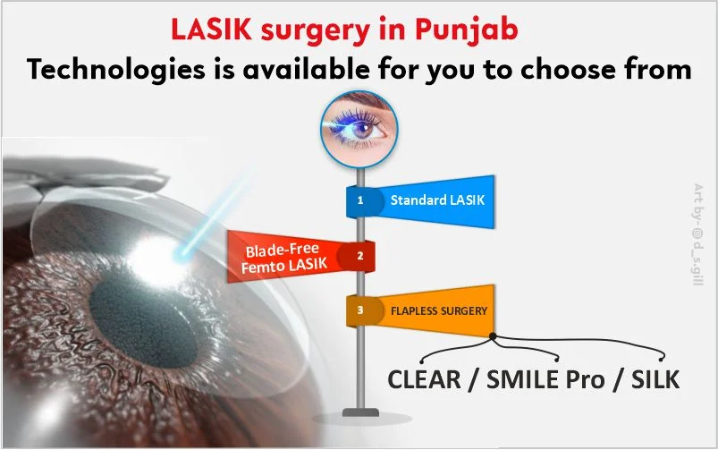 Best LASIK Surgery in Punjab