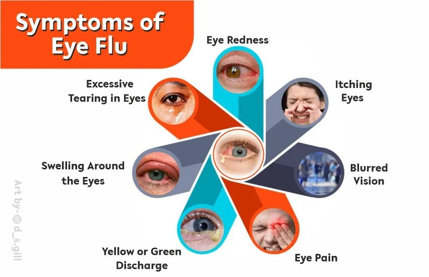Symptoms of eye flu