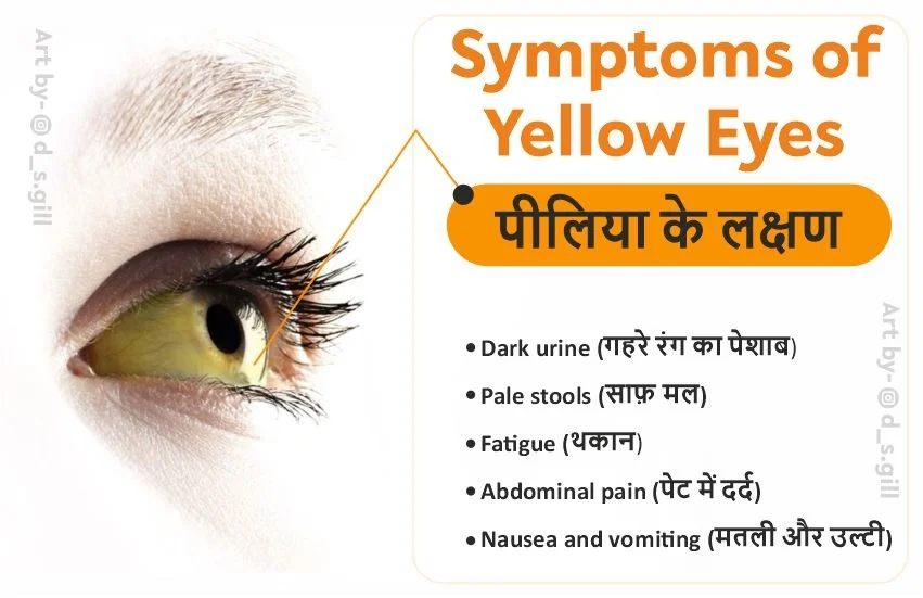 Yellow Eyes