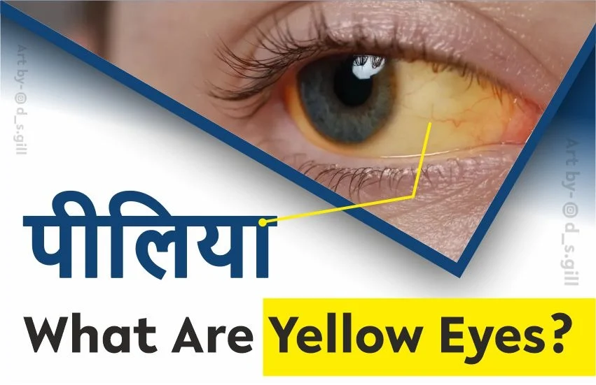 Yellow Eyes