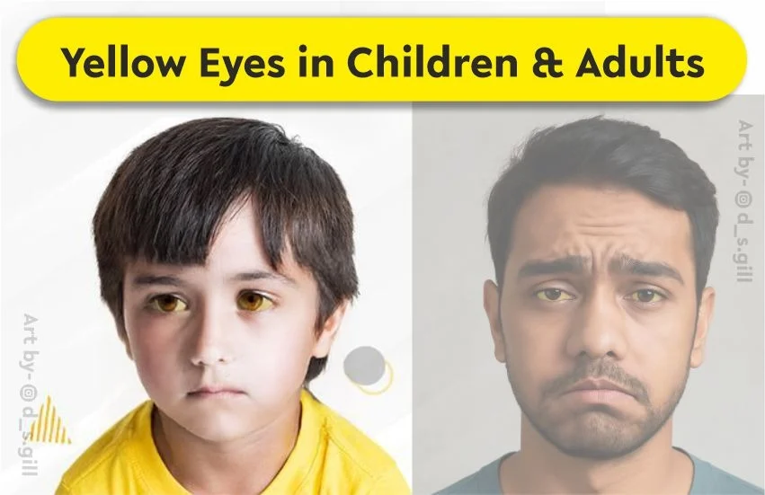 Yellow Eyes